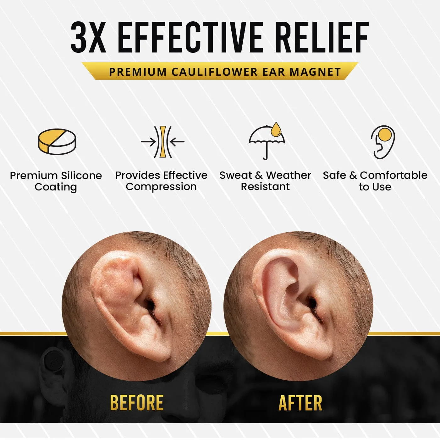 Cauliflower Ear Treatment Magnet Kit